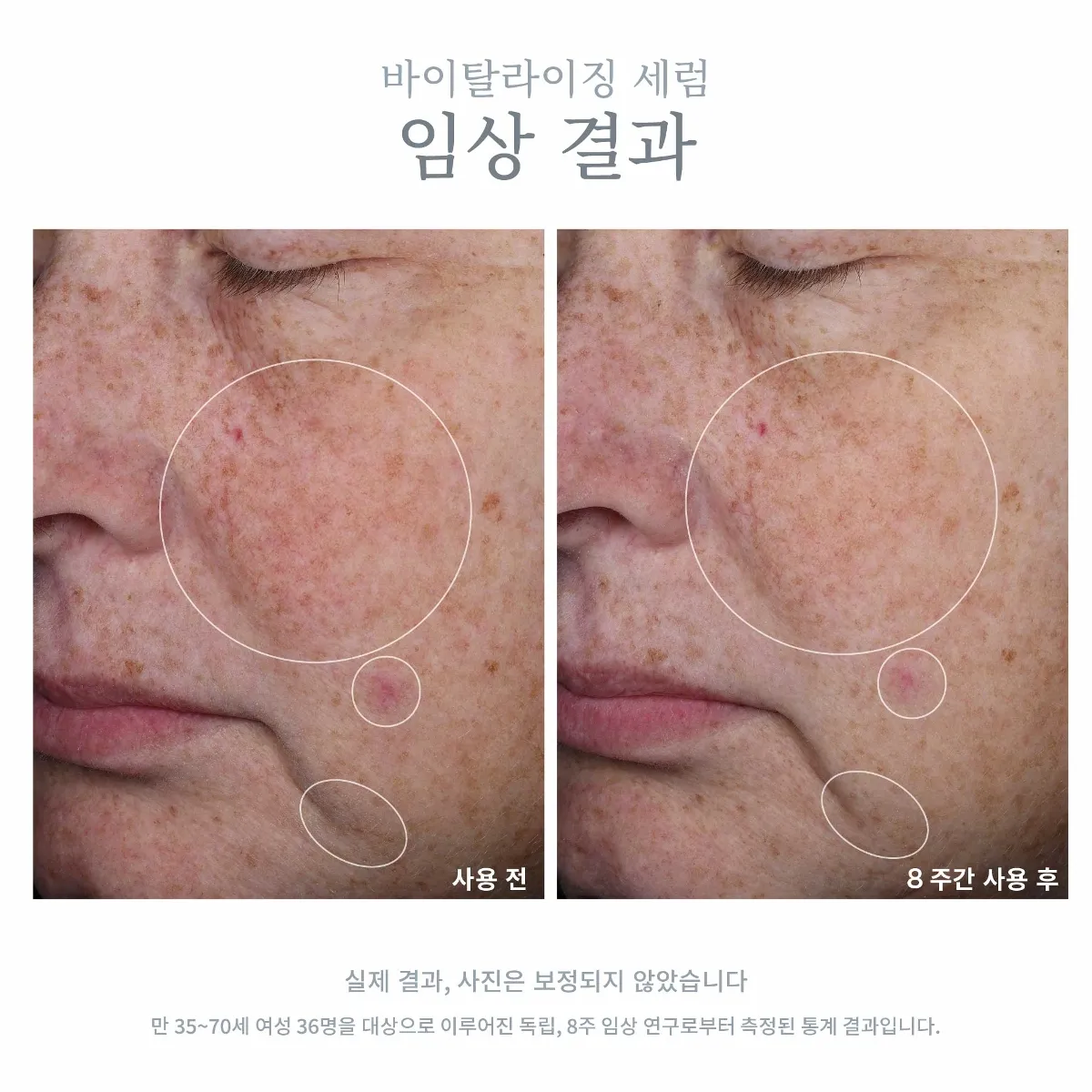 셀라비브 바이탈라이징 세럼 사용 전·후