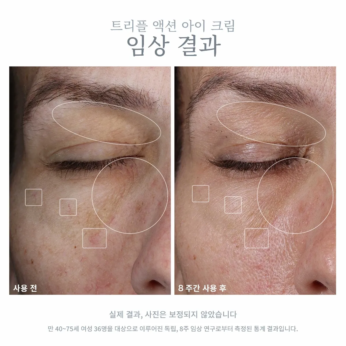 셀라비브 트리플 액션 아이 크림 사용 전·후